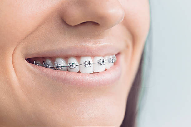 Best Tooth Extraction  in Lebanon, IL